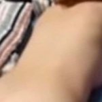 Medical Ass Butt Injection Free Butt Ass Porn 69 mpeg4