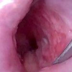 Japanese Wife Open Cervix Wide to watch inside Uterus
