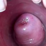 Extreme Cervix Electrosex with sound depth into Womb