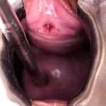 Extreme Cervix Penetration Sounds Speculum Uterus Dilation: Shemale POV Porn feat. Trip Richards