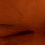 Post op cum dripping
