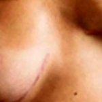 Pose nude? No way. After breast cancer? OK!