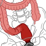 An In-Depth Guide to Anal Training Stretching Gaping