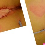 Interdisciplinary aspects of abdominal and plastic surger...